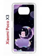 Чехол-накладка Xiaomi Poco X3/Poco X3 Pro Kruche Print Сон медвежонка