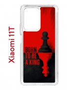 Чехол-накладка Xiaomi 11T/11T Pro Kruche Print Born to be a King