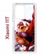 Чехол-накладка Xiaomi 11T (612848) Kruche PRINT Человек паук