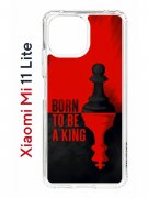 Чехол-накладка Xiaomi Mi 11 Lite (623777) Kruche PRINT Born to be a King