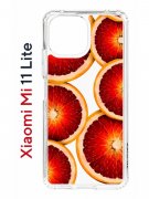 Чехол-накладка Xiaomi Mi 11 Lite (623777) Kruche PRINT Orange