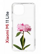 Чехол-накладка Xiaomi Mi 11 Lite/Mi 11 Lite 5G Kruche Print Пион