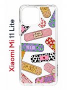 Чехол-накладка Xiaomi Mi 11 Lite/Mi 11 Lite 5G Kruche Print Милые пластыри