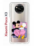 Чехол-накладка Xiaomi Poco X3 (593960) Kruche PRINT This is life