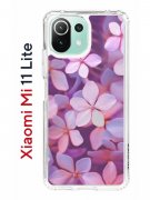 Чехол-накладка Xiaomi Mi 11 Lite (623777) Kruche PRINT Гортензия