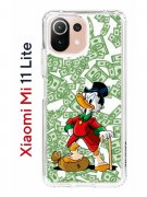 Чехол-накладка Xiaomi Mi 11 Lite (623777) Kruche PRINT MacMoney