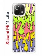 Чехол-накладка Xiaomi Mi 11 Lite/Mi 11 Lite 5G Kruche Print Абстракция Капли
