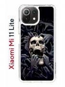 Чехол-накладка Xiaomi Mi 11 Lite (623777) Kruche PRINT Skull Hands