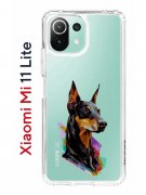 Чехол-накладка Xiaomi Mi 11 Lite (623777) Kruche PRINT Доберман