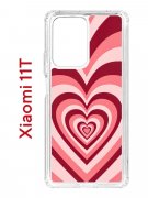 Чехол-накладка Xiaomi 11T (612848) Kruche PRINT Сердце