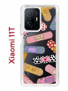 Чехол-накладка Xiaomi 11T/11T Pro  Kruche Print Милые пластыри