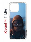 Чехол-накладка Xiaomi Mi 11 Lite (623777) Kruche PRINT Северный Паук