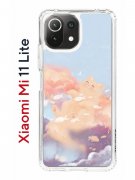 Чехол-накладка Xiaomi Mi 11 Lite (623777) Kruche PRINT Dafna_Cloud cat