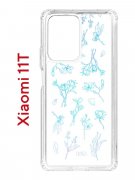 Чехол-накладка Xiaomi 11T (612848) Kruche PRINT Dafna_Spring flowers (в цвете)