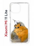 Чехол-накладка Xiaomi Mi 11 Lite (623777) Kruche PRINT Dafna_Sweetie bird