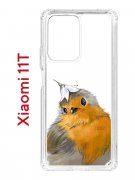 Чехол-накладка Xiaomi 11T (612848) Kruche PRINT Dafna_Sweetie bird