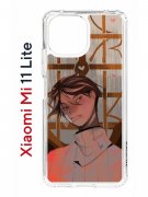 Чехол-накладка Xiaomi Mi 11 Lite (623777) Kruche PRINT Чувства Бена