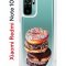 Чехол-накладка Xiaomi Redmi Note 10 (596589) Kruche PRINT Donuts