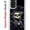 Чехол-накладка Xiaomi Redmi Note 11  (623778) Kruche PRINT Skull Hands
