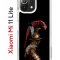 Чехол-накладка Xiaomi Mi 11 Lite/Mi 11 Lite 5G Kruche Print Гладиатор
