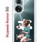 Чехол-накладка Huawei Nova 9 (610635) Kruche PRINT Рисуя любовь