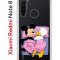 Чехол-накладка Xiaomi Redmi Note 8  (580659) Kruche PRINT This is life