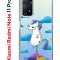 Чехол-накладка Xiaomi Redmi Note 11 Pro (637293) Kruche PRINT Flying Unicorn