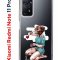 Чехол-накладка Xiaomi Redmi Note 11 Pro (637293) Kruche PRINT Рисуя любовь